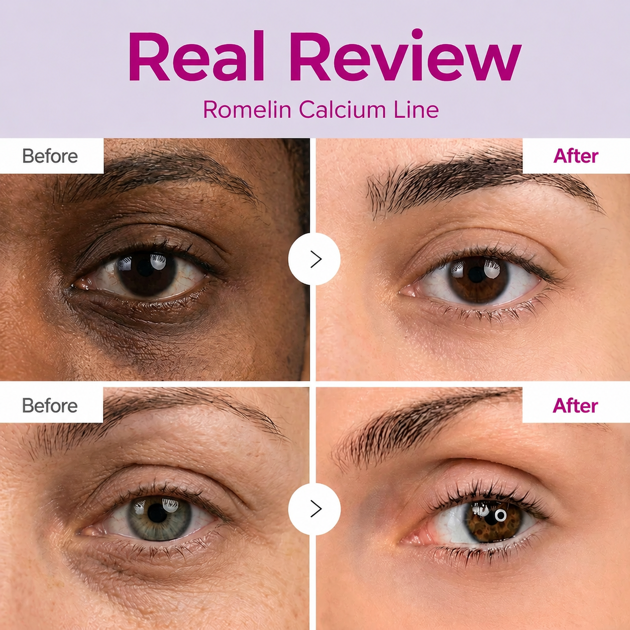 ROMELIN Korean Calcium Dark Spot Eye Cream