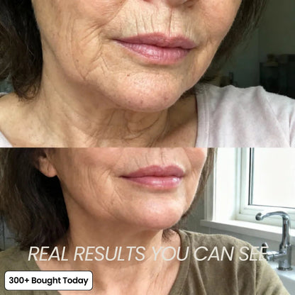 ROMELIN Korean Pink Collagen Volume Multi Balm