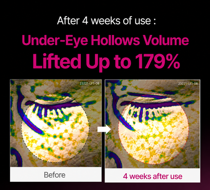 ROMELIN Korean Calcium Dark Spot Eye Cream